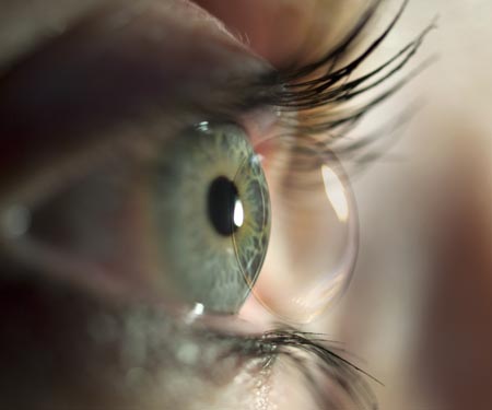Kontaktlinse noch vor dem Auge
