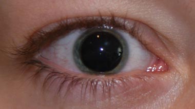 Augen große pupillen blaue 
